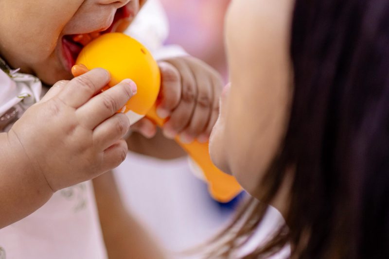 Destinan Fondo Gadiel a cirugías para niños con labio leporino
