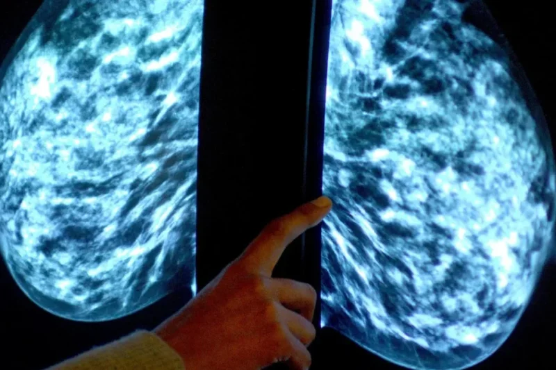 Cerca de 7,500 personas han padecido cáncer en RD entre el 2019 y el 2025; mujeres duplican en casos a hombres